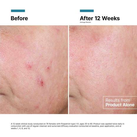 Skinceuticals Advanced RGN-6 50ml