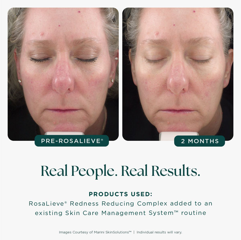 Jan Marini RosaLieve Redness Reducing Complex 30ml