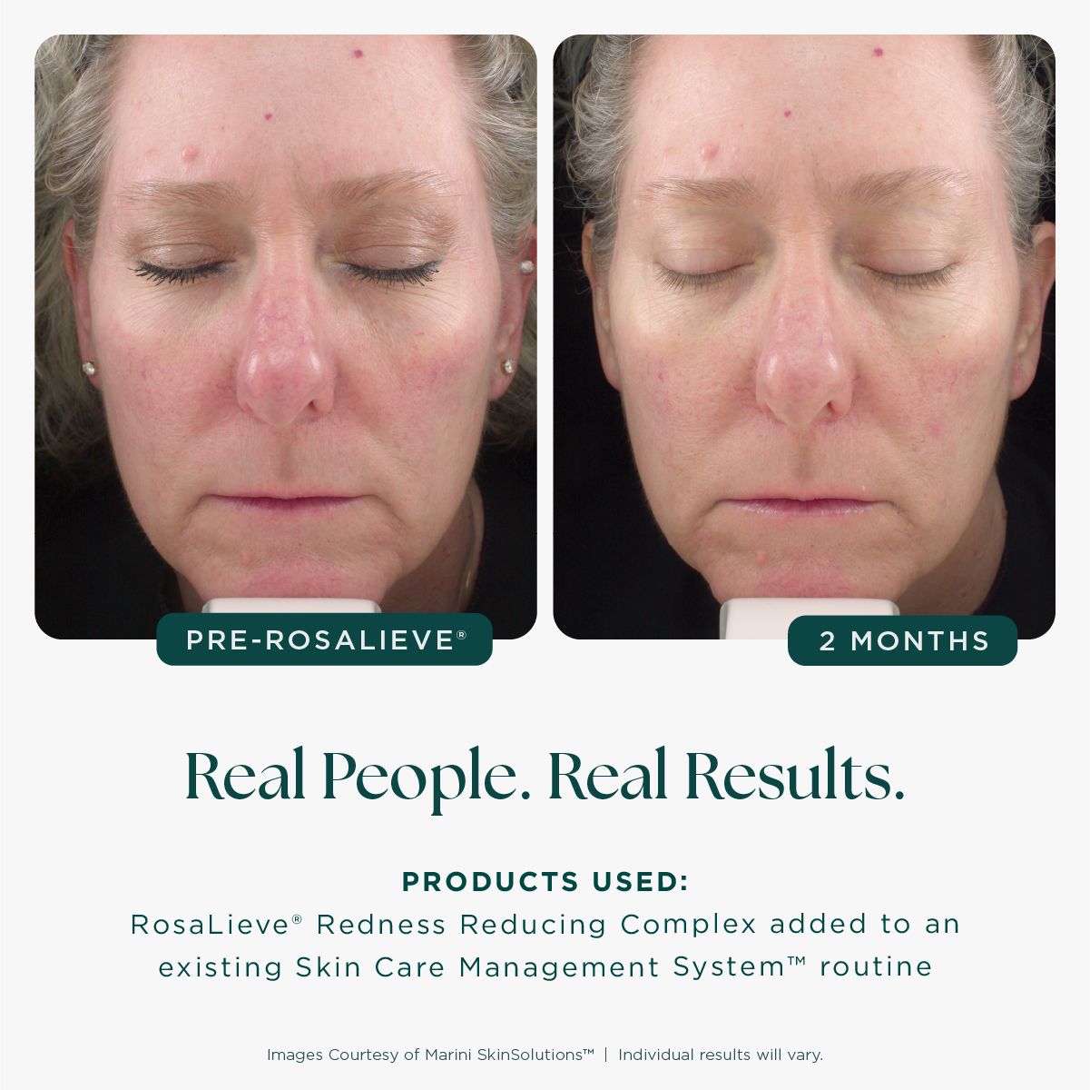 Jan Marini RosaLieve Redness Reducing Complex 30ml