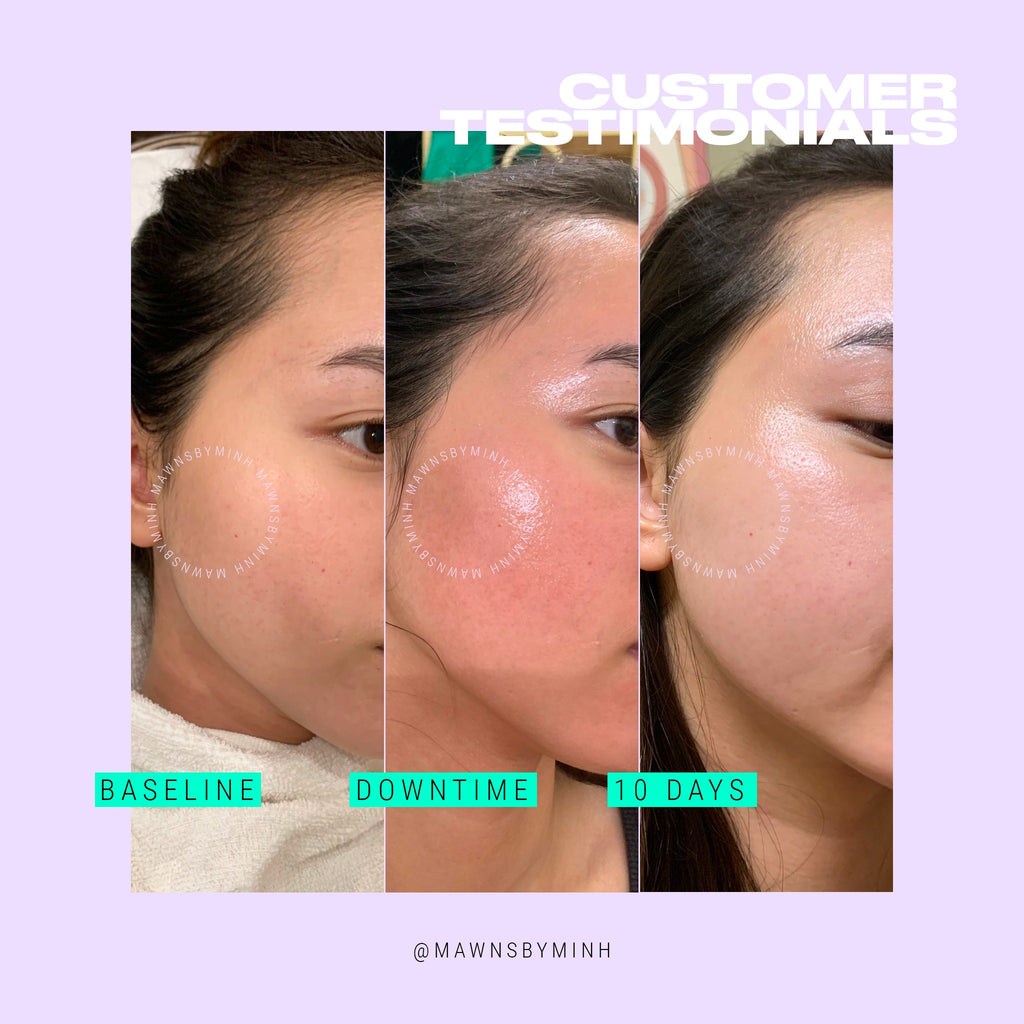 Innoaesthetics Inno-Exfo Lightening 15g