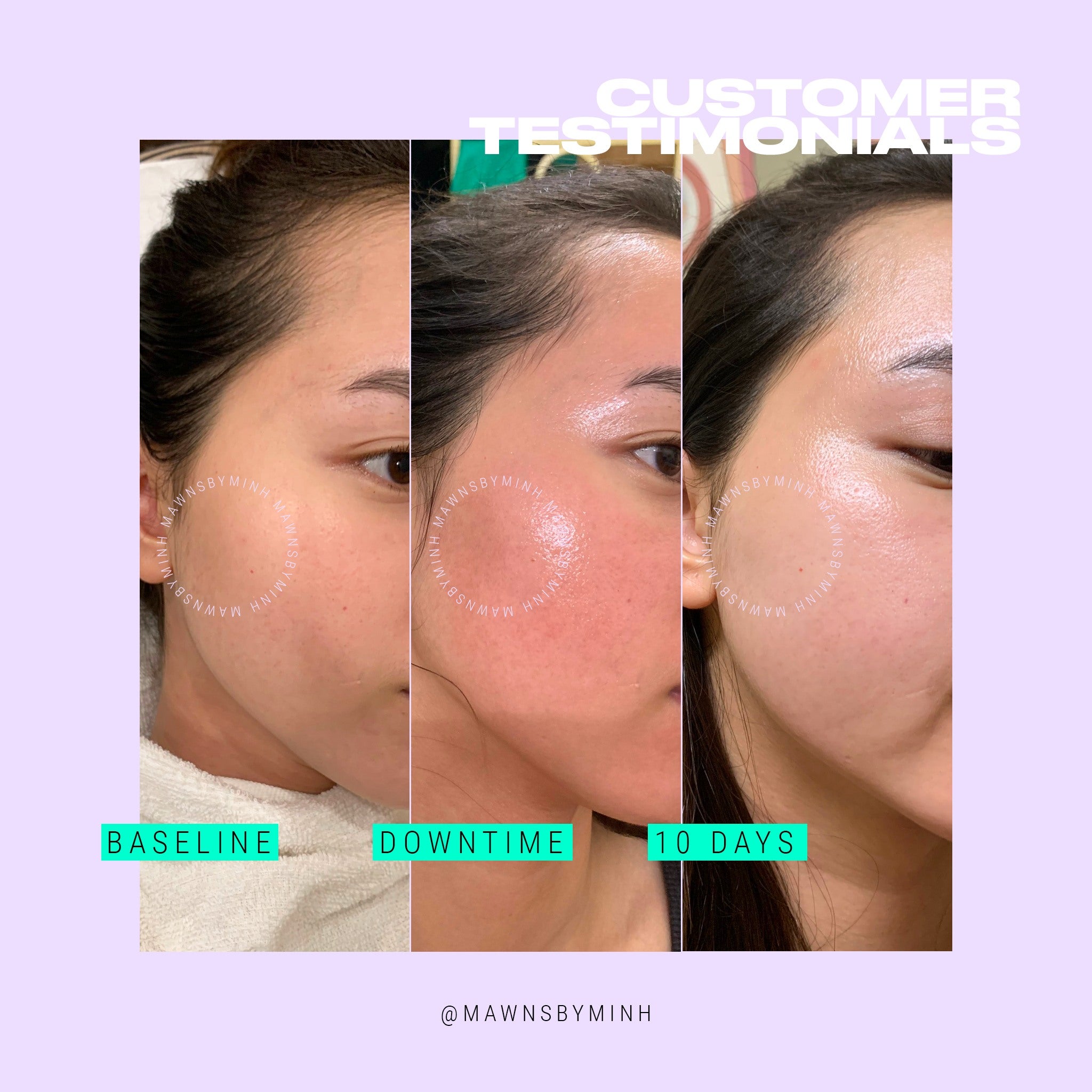 Innoaesthetics Inno-Exfo Lightening 15g