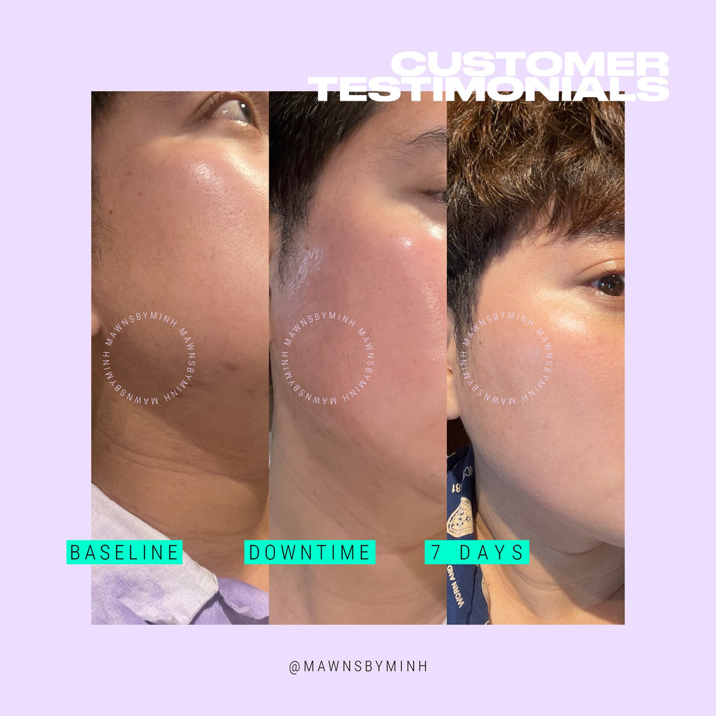 Innoaesthetics Inno-Exfo Lightening 15g